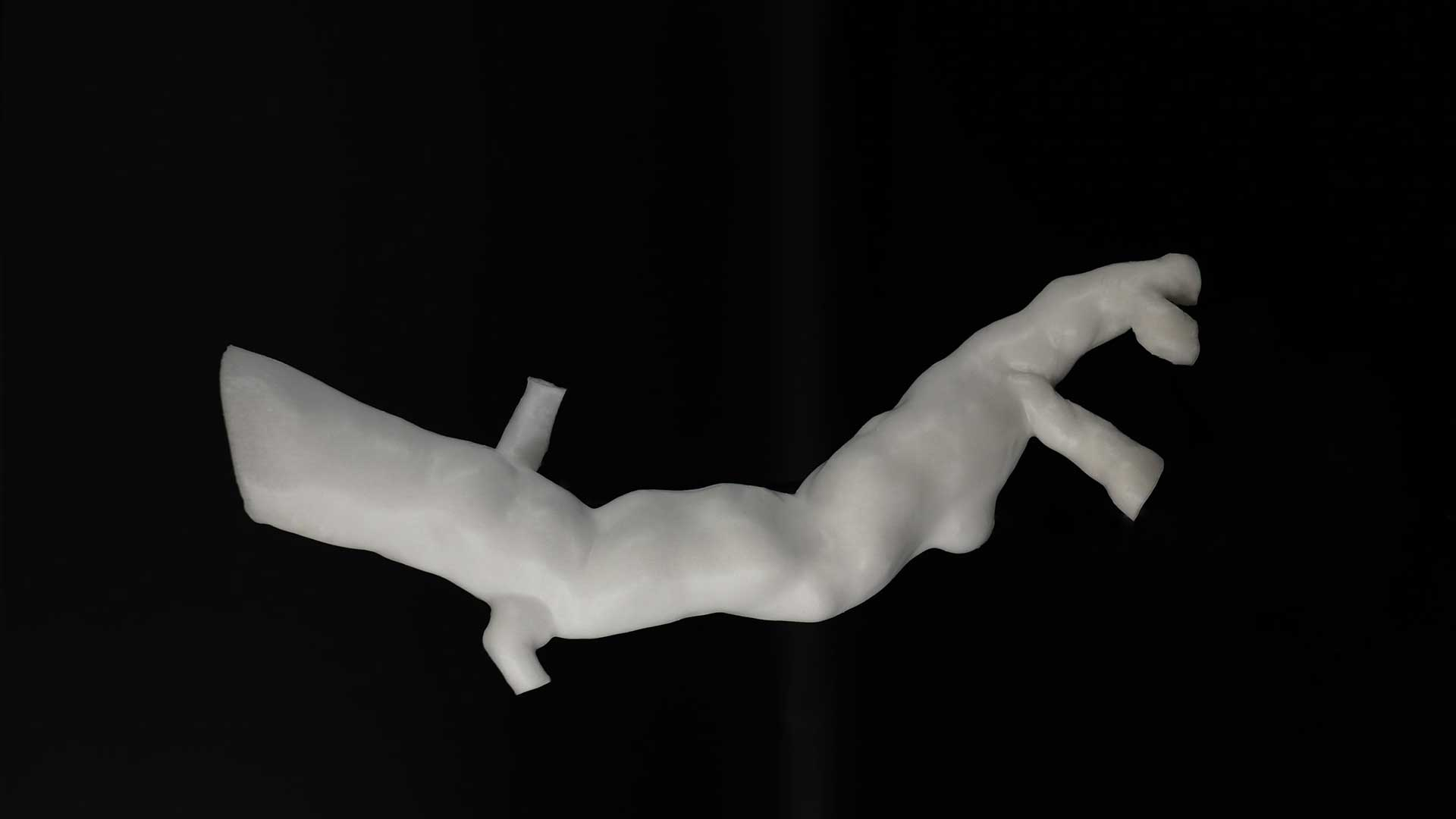 aorta