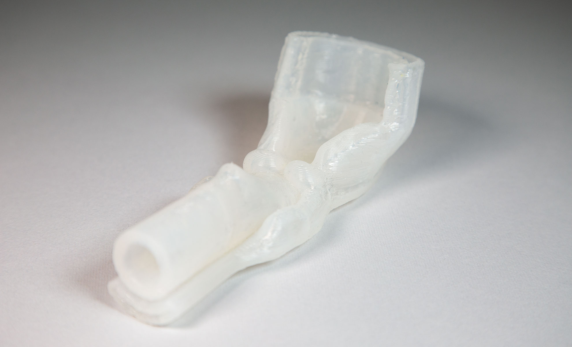 impression-3D-Larynx