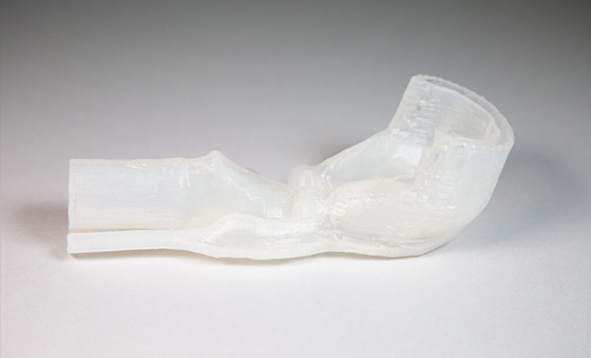 larynx